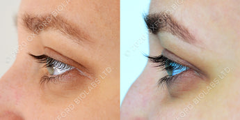 Eyelash Case 1