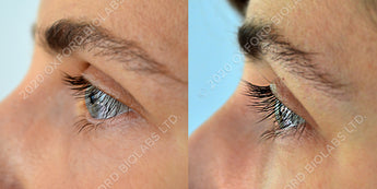 Eyelash Case 3
