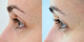 Eyelash Case 5