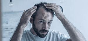 Could Stress be the Cause of your Hair Loss?